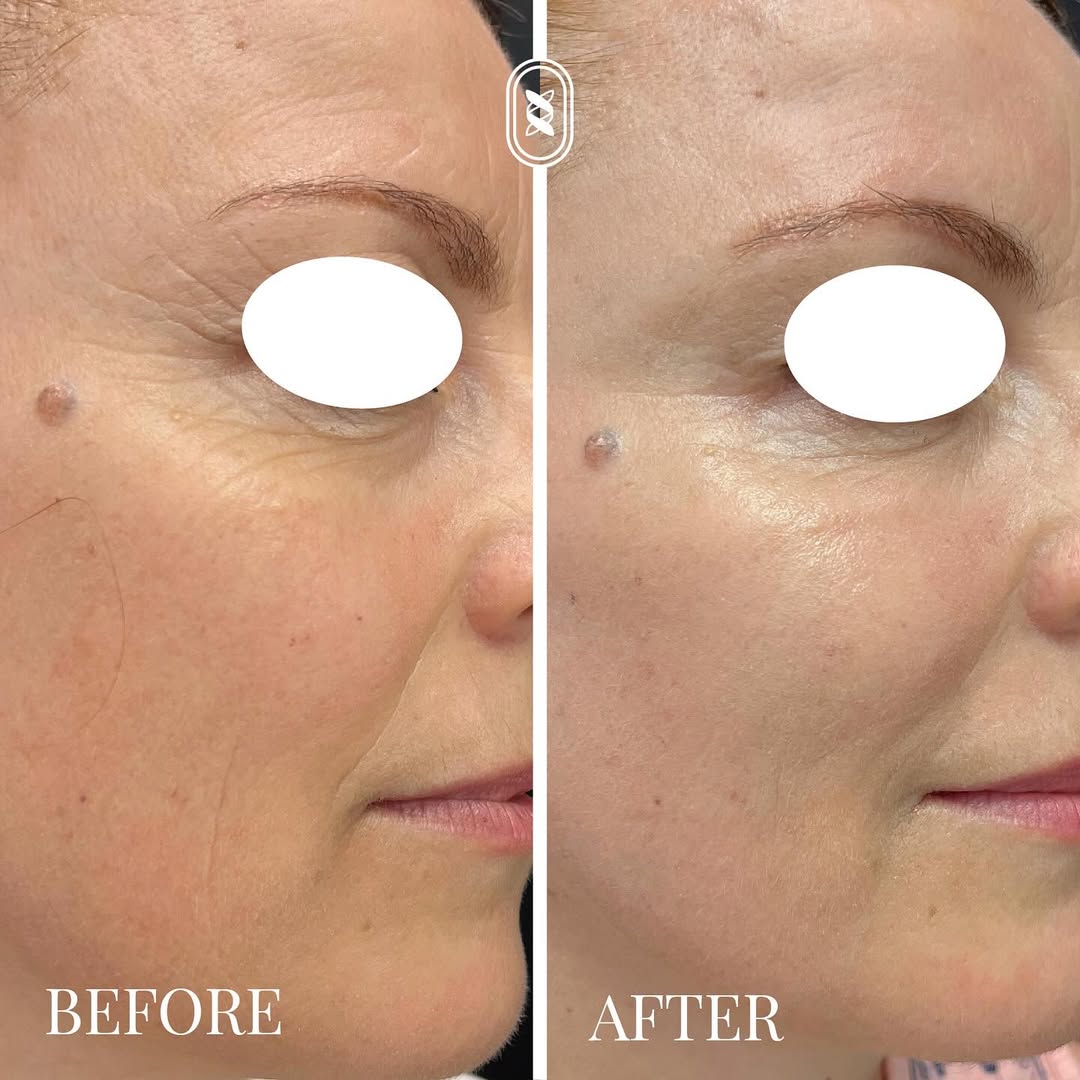 Jamber before and after result, case 19