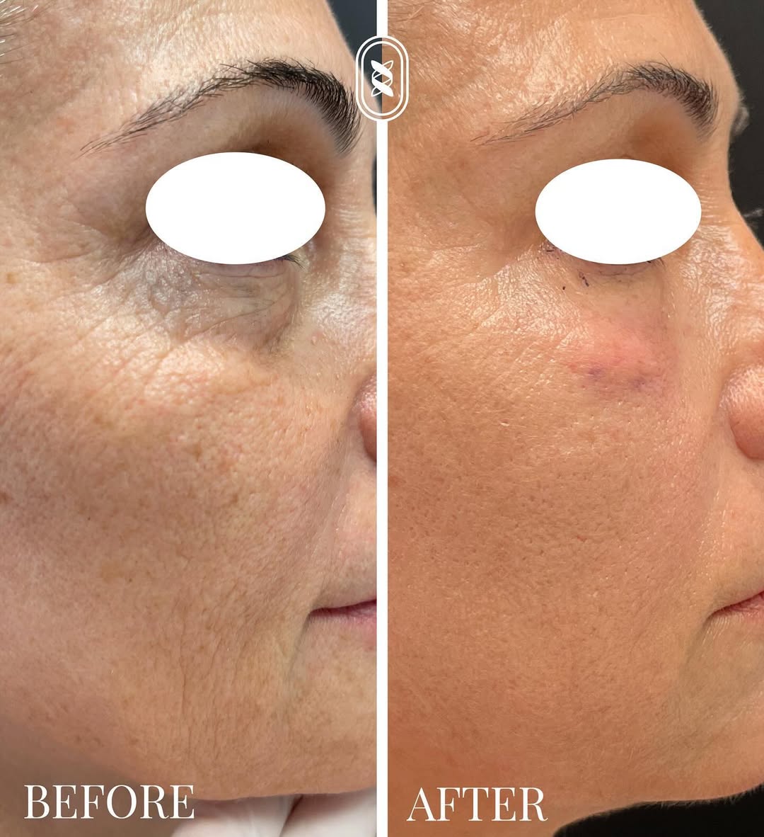 Jamber before and after result, case 15