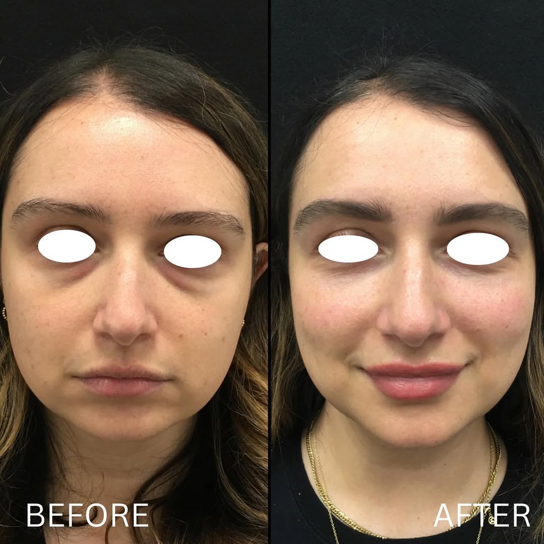 Jamber before and after result, case 12