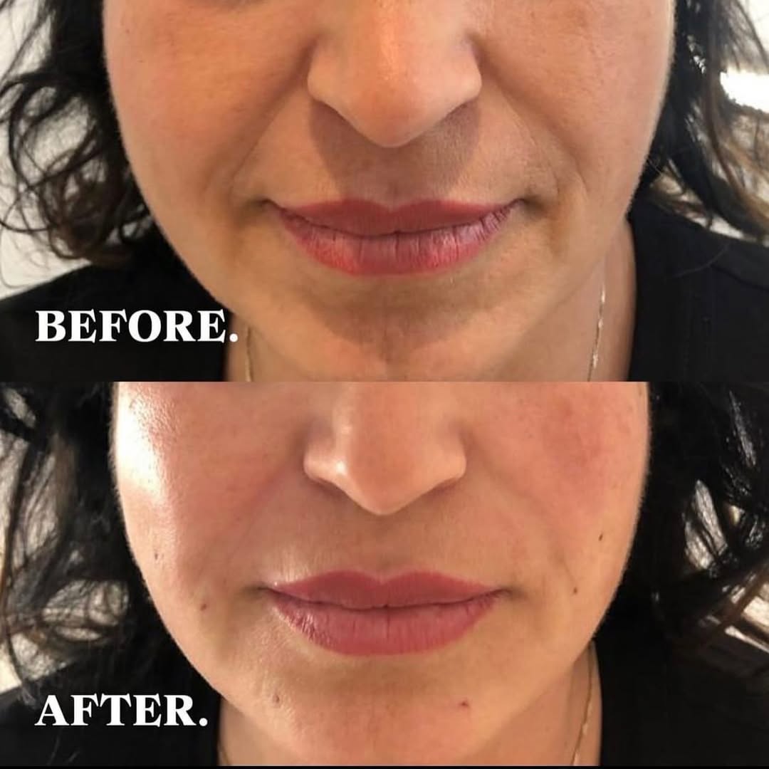 Jamber before and after result, case 10